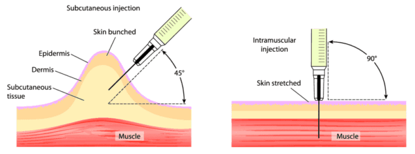 Diagram showing difference between subcutaneous and intramuscular hcg injections